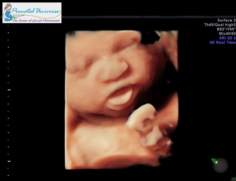 3d ultrasound baby is yawning