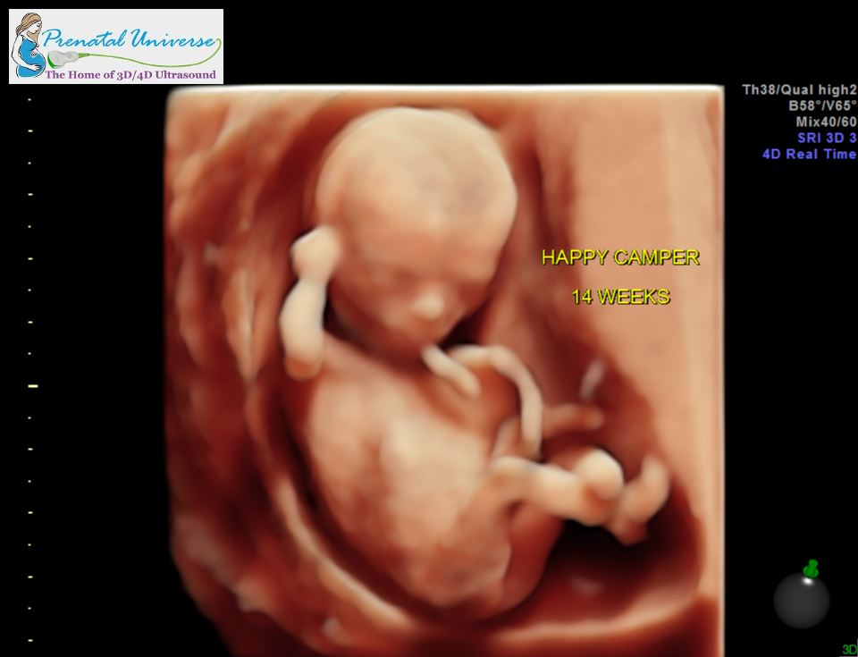 4D HD Ultrasound Image Gallery | Prenatal Universe Ultrasound