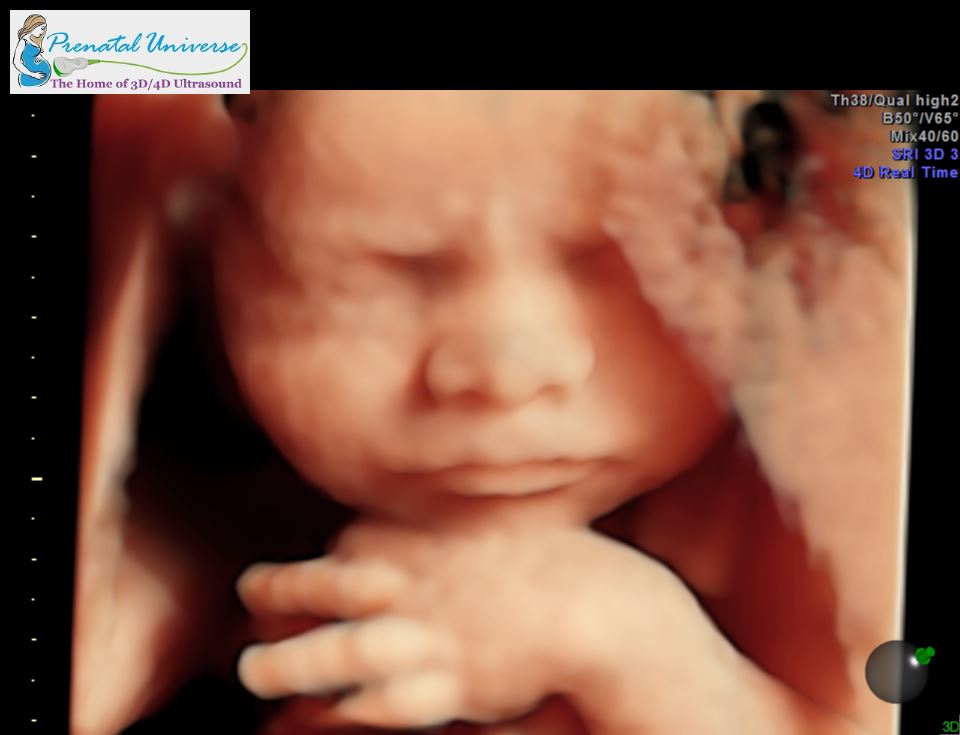 cute 3D ultrasound picture