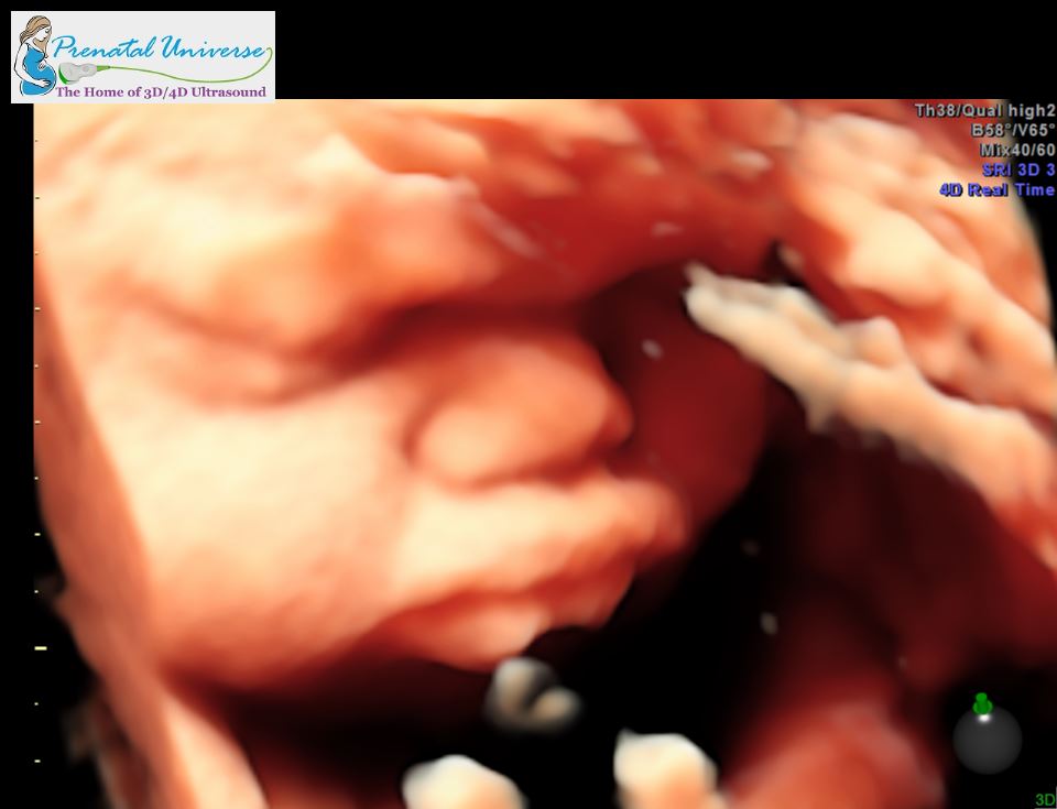 hd live ultrasound close up