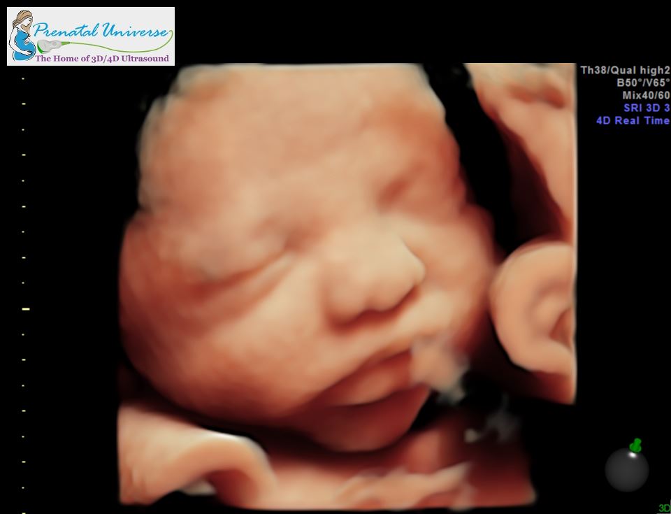 this is what quality 3d ultrasound looks like
