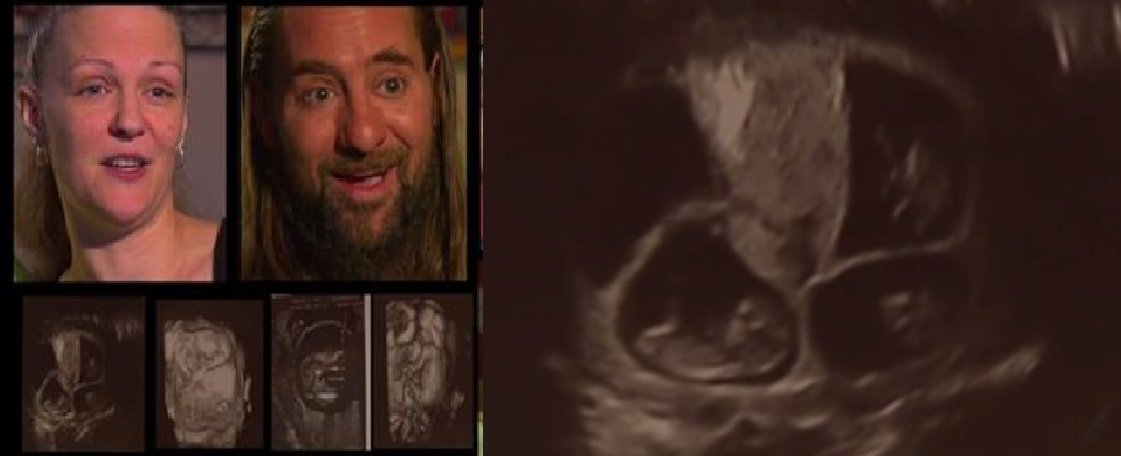 Mom Is In For a Routine Ultrasound, But Doctor Says “Oh My Gosh” After Seeing 3 Babies