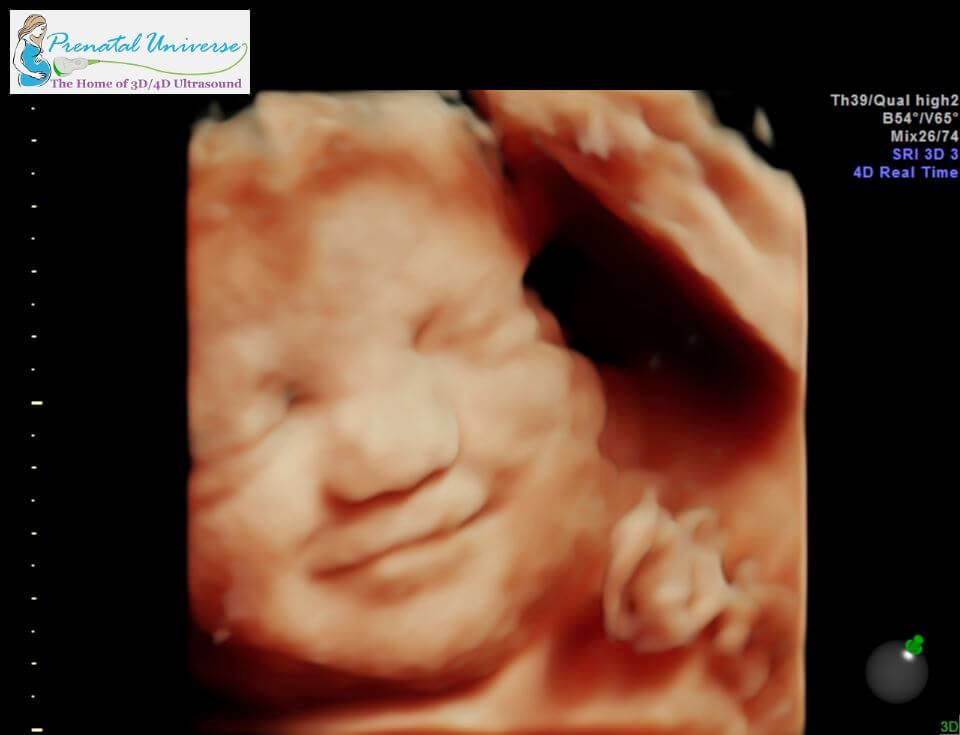 3D Ultrasound Pricing Prenatal Universe Tacoma WA.