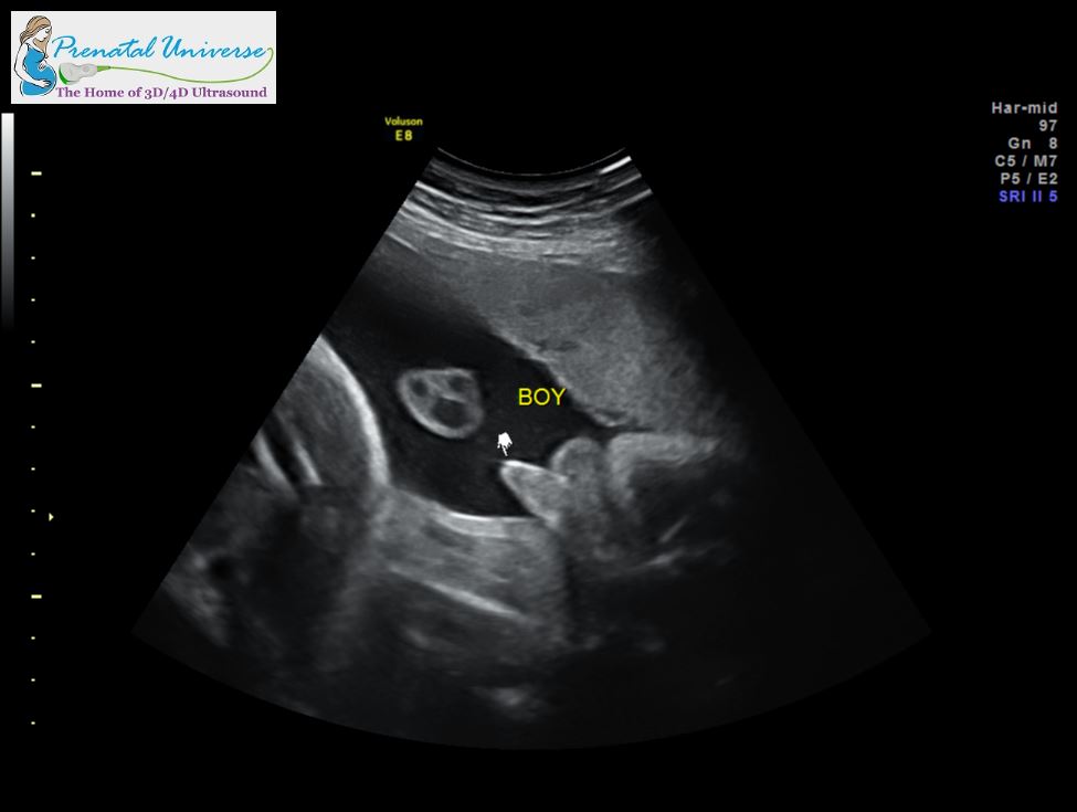 3D Ultrasound Pricing - Prenatal Universe - Tacoma, WA